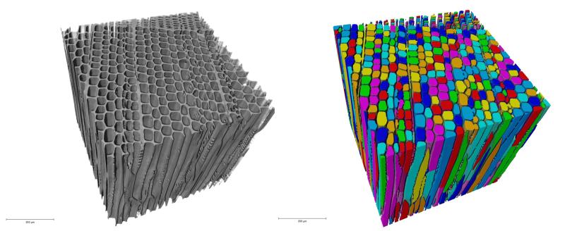 résultats tomographie X