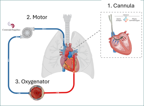 Projet Bioartlung